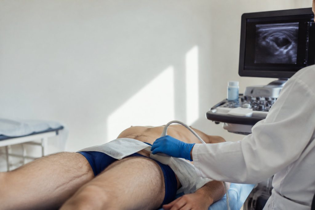 Un médecin effectue une échographie de la zone pelvienne d'un patient allongé sur une table d'examen médical.