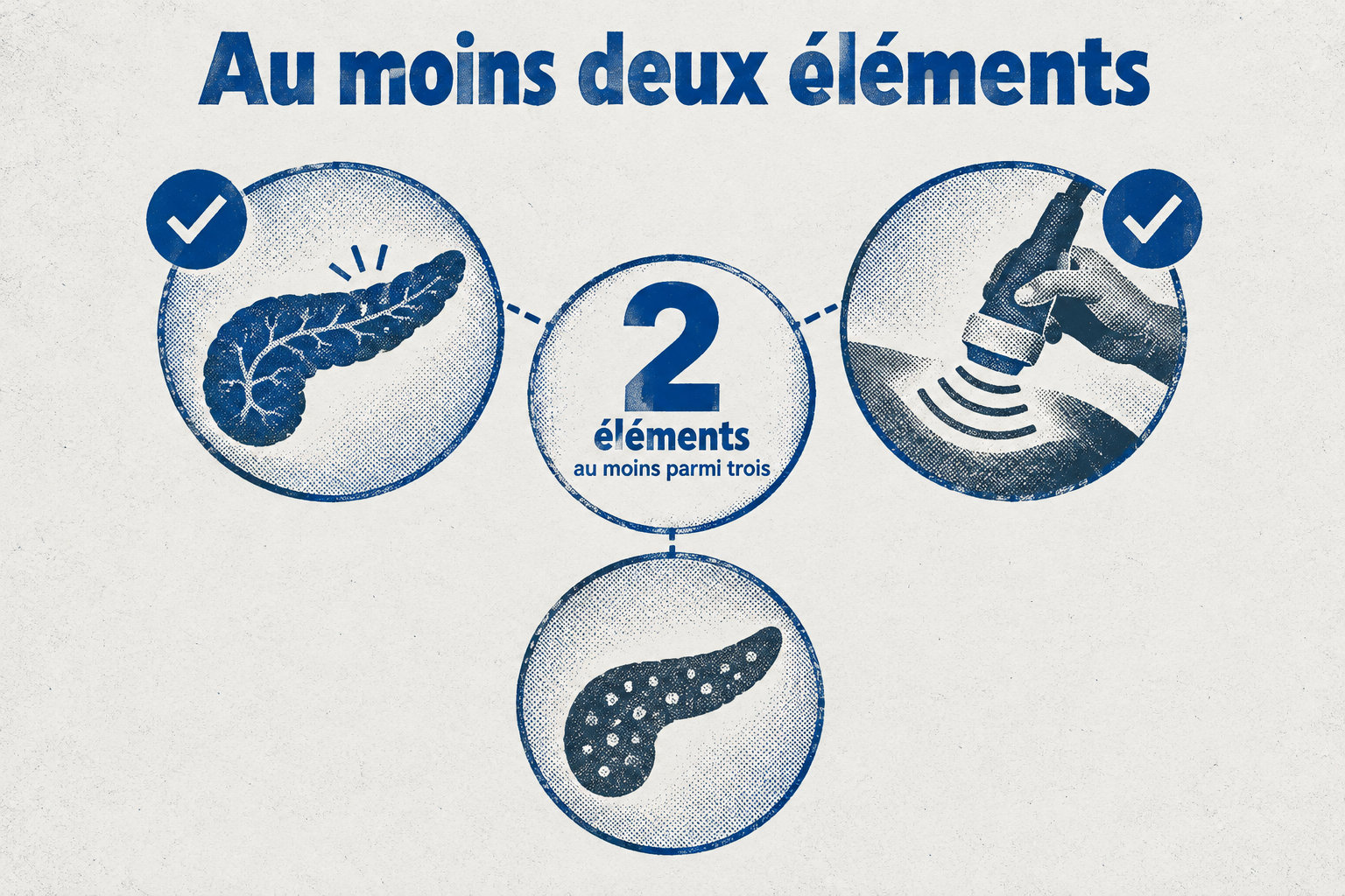Le diagnostic de pancréatite aiguë repose sur au moins deux éléments parmi trois : douleur caractéristique, lipase élevée et signes typiques à l’imagerie.